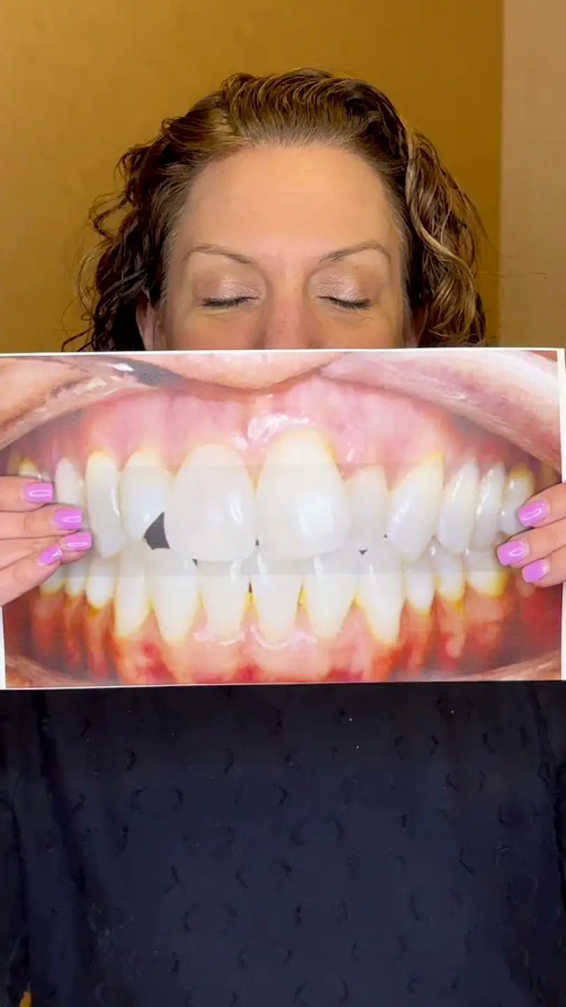 Springfield One Smile Orthodontics