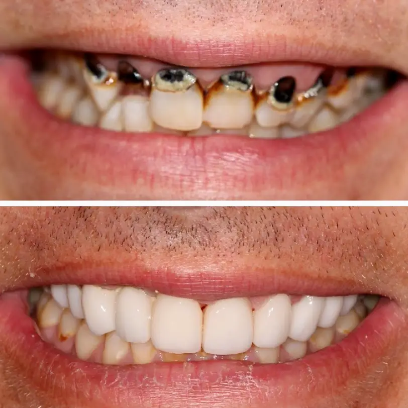 Brenham Dream Dental