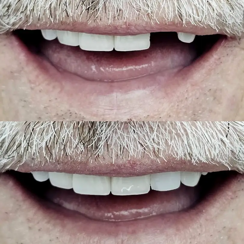 Coconut Creek Cosmetic and Implant Dentistry