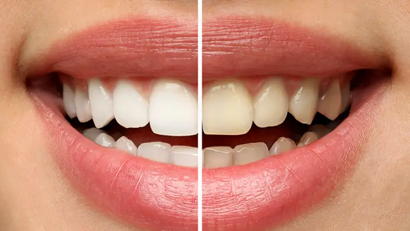 Towson Platinum Whitening Studio