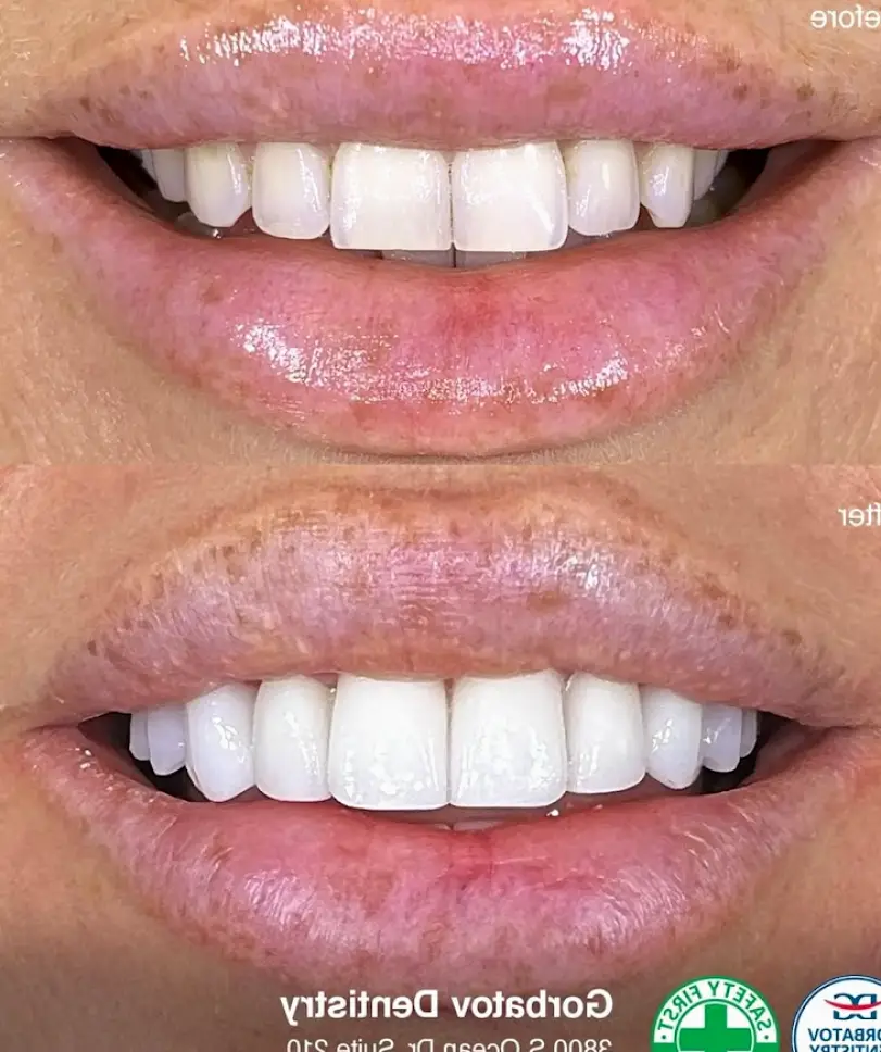  Hollywood Dr. Gorbatov Dentistry