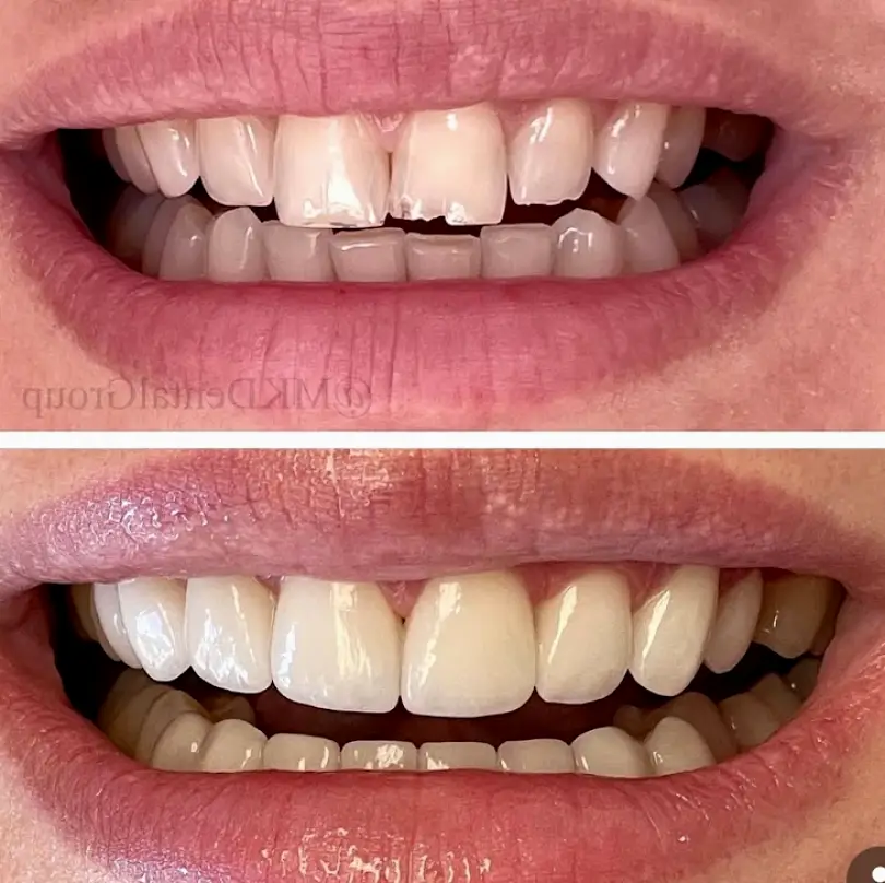Porter Ranch MK Dental Group