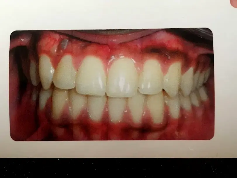  Colorado Springs Bailey Orthodontics