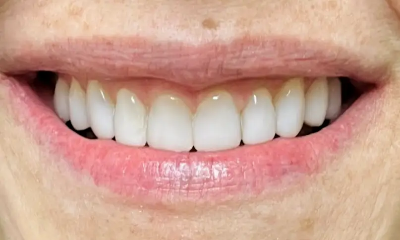 Laguna Niguel Richard O'Braitis DDS