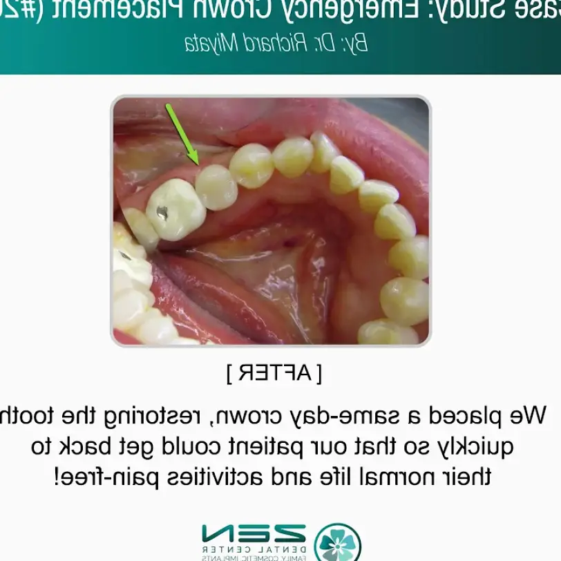 Seattle Zen Dental Center Family Cosmetic Emergency Implants