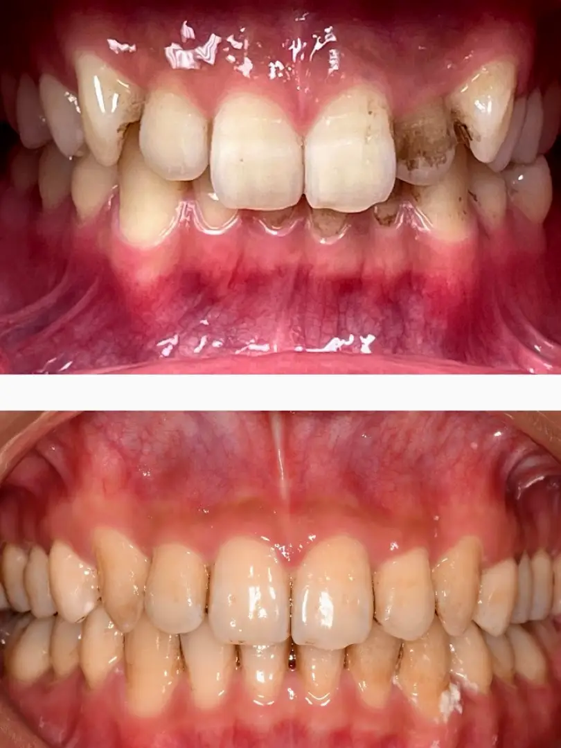 Brookline Ascend Dental Studio PLLC