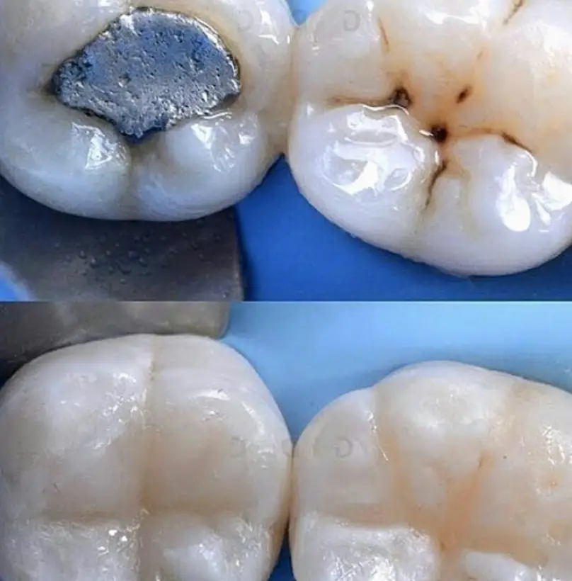  Hollywood Sheridan Dental Care (Dr Dorene Montero and Dr Fernando Quevedo)