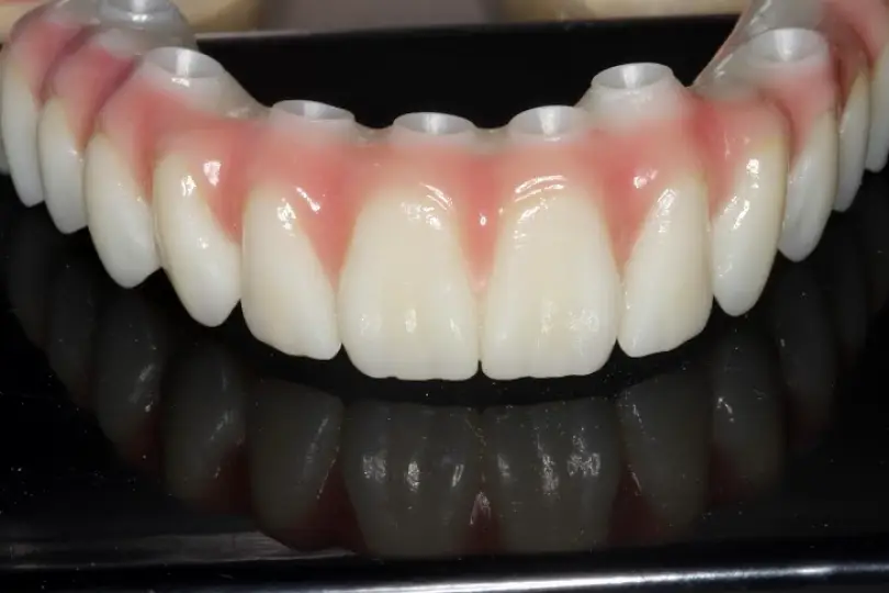 Meridian Dental Implant Solutions of Idaho