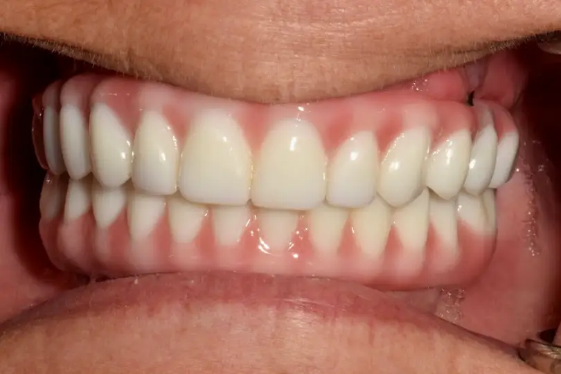 West Palm Beach Omar Abdo, DDS, MS, FACP