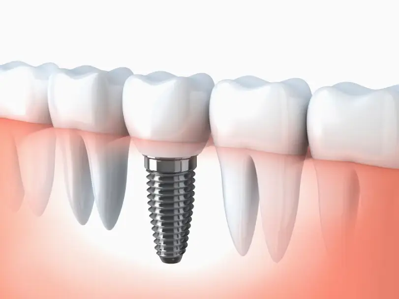 Norco Hills Advanced Dentistry