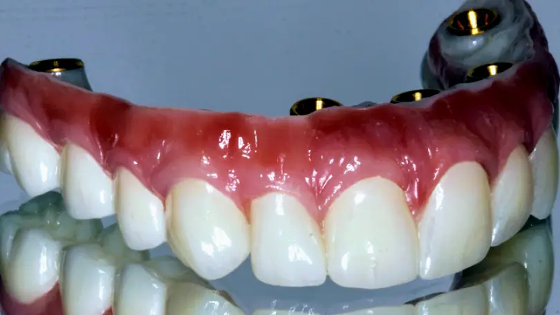 Novato Marin Dental Implant Center
