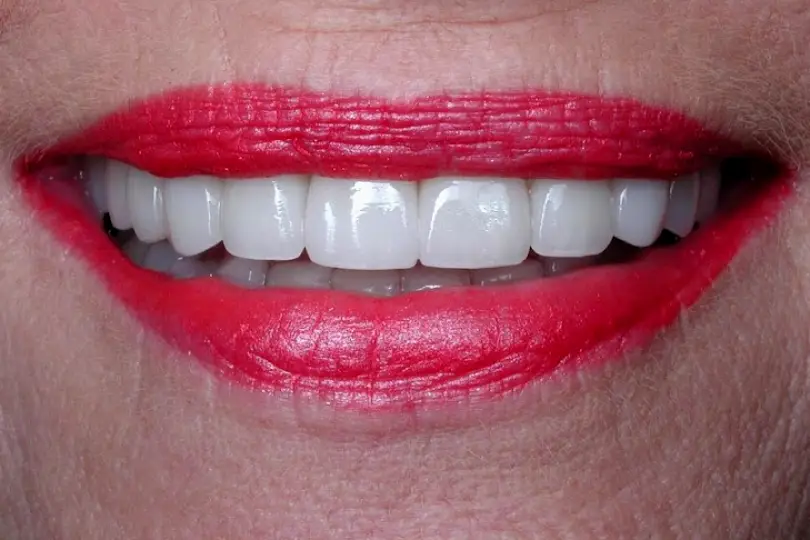 Adobe Dental Design of Sedona