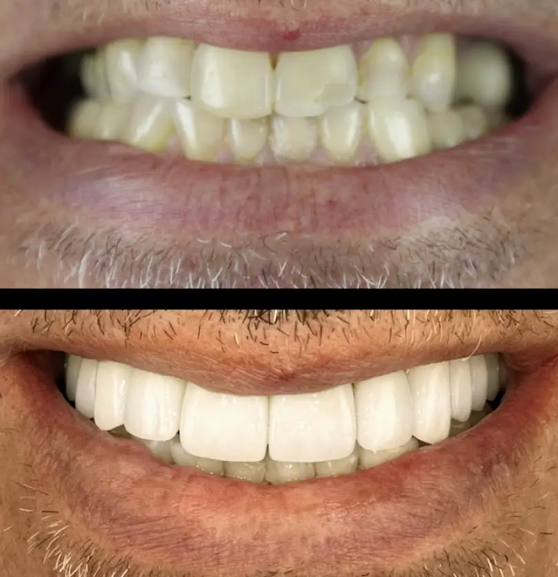  Allure Dental Chicago - Lakeview