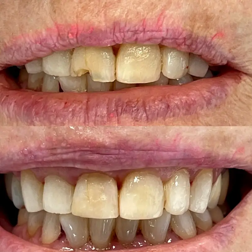 Encino Give Dental