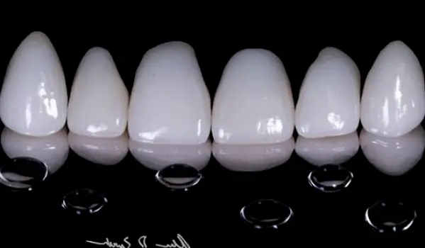 Naperville Ascend Dental - Dr. Zurek and Dr. Sikora