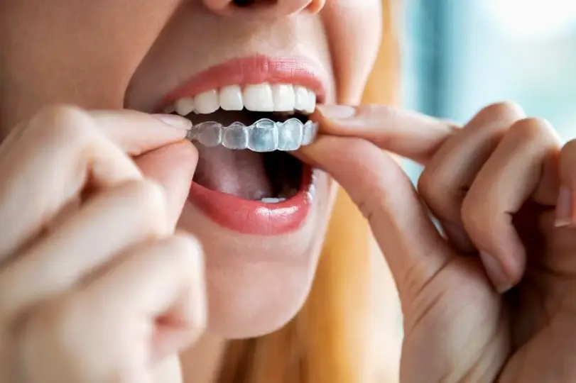 Smithtown Fran Eichler DDS - General & Family Dentistry