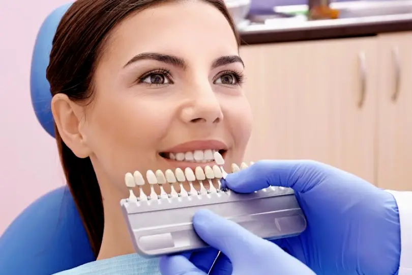 Vancouver Vista Dental Veneers