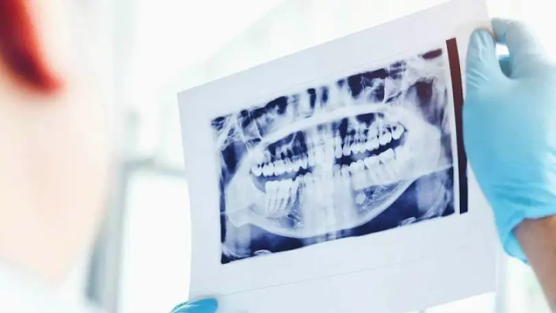 Lawrence Natela Dallet, DDS