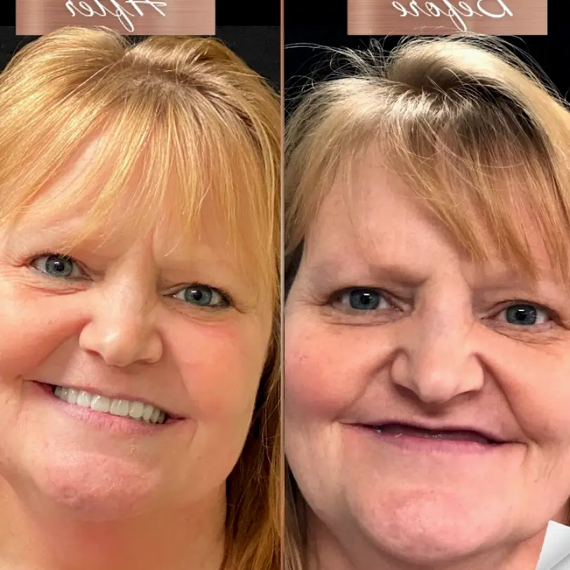 Lemont Start Smiling Dental Implant Centers