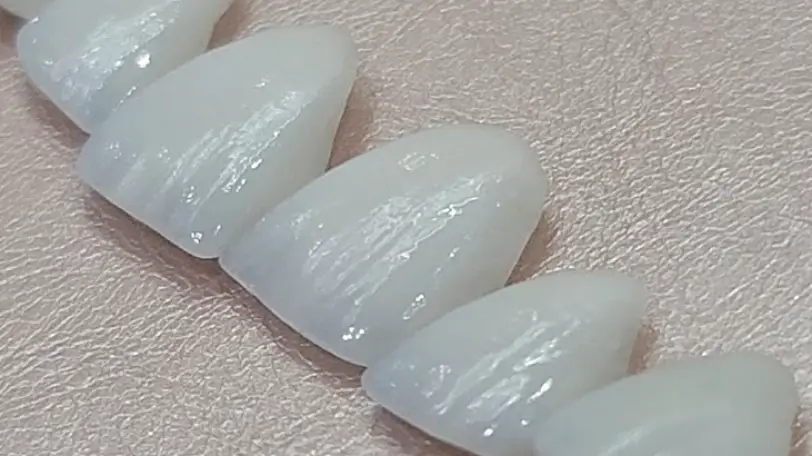Sunny Isles Beach Dentist