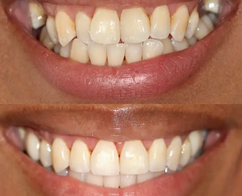 Glenview Prime Dental Specialists: Samantha Chou