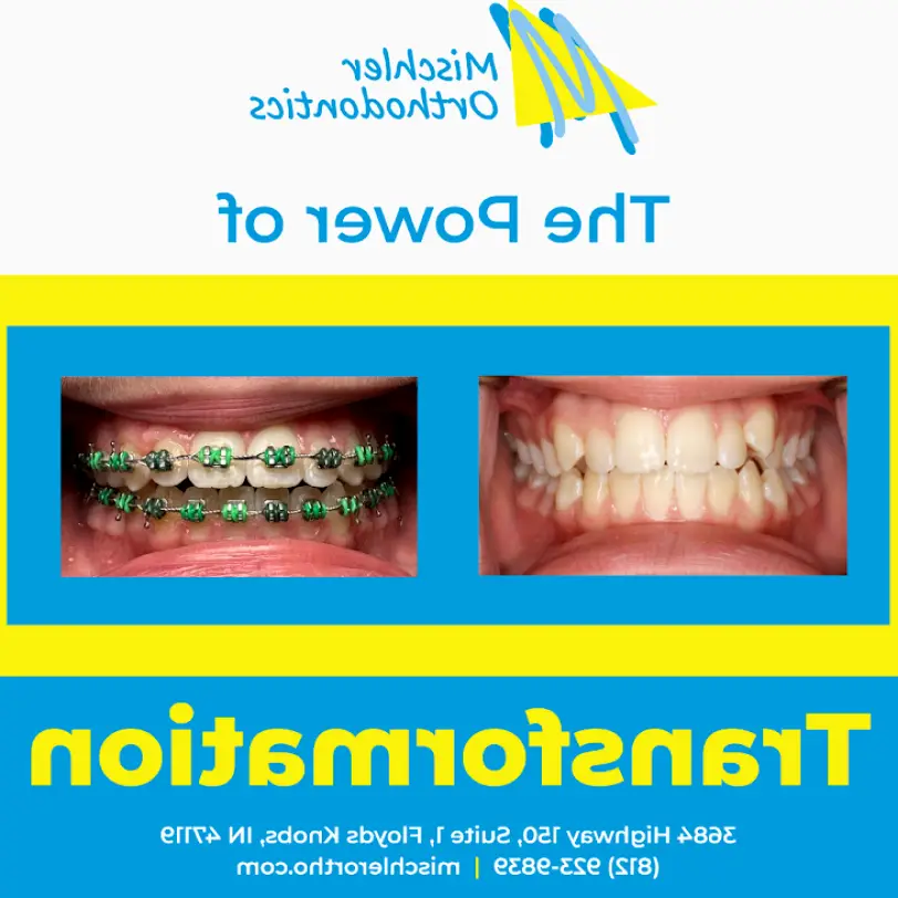 Floyds Knobs Mischler Orthodontics