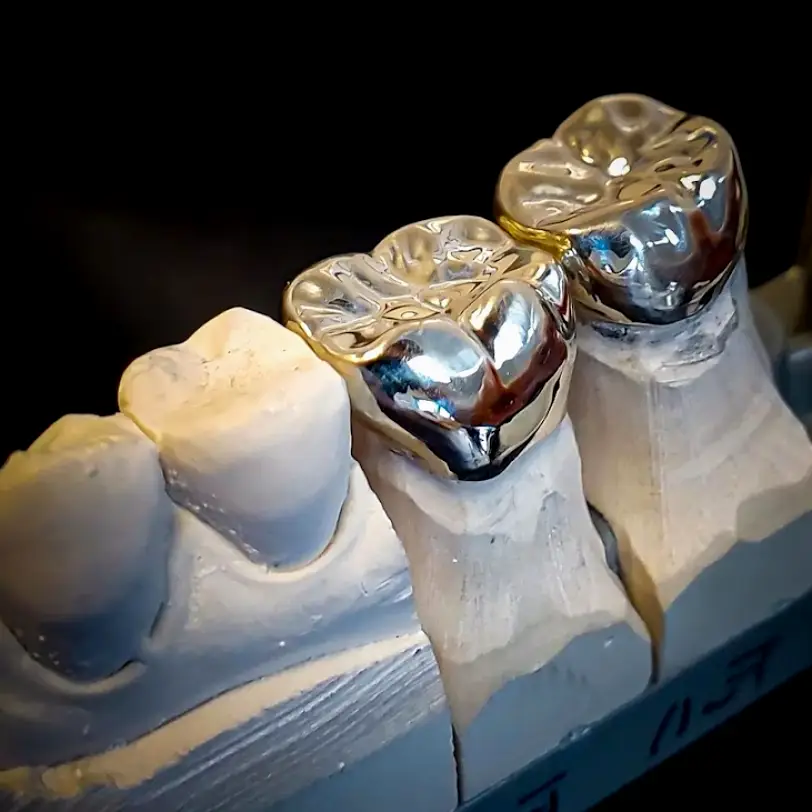 Kalispell Montana Dental Designs - Dr. Tim Mathews