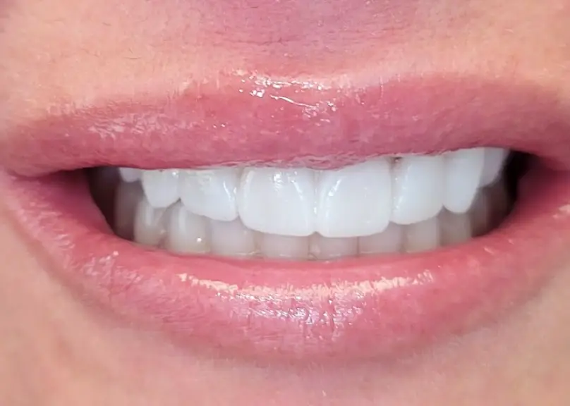 Lakewood CLE Smiles by Dr. Niki: Nicole Cochran, DDS