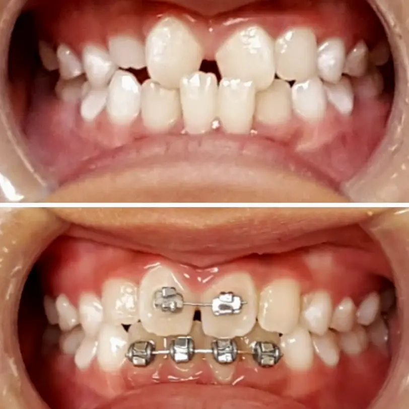 Warner Dental - Fountain Valley