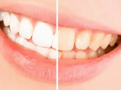 Holistic Dentistry Studio City