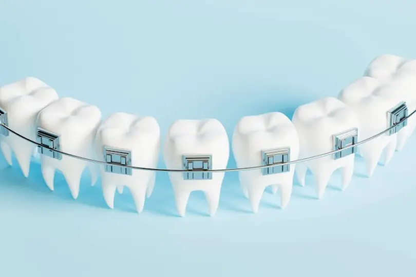 Flat Rock Upwards Orthodontics