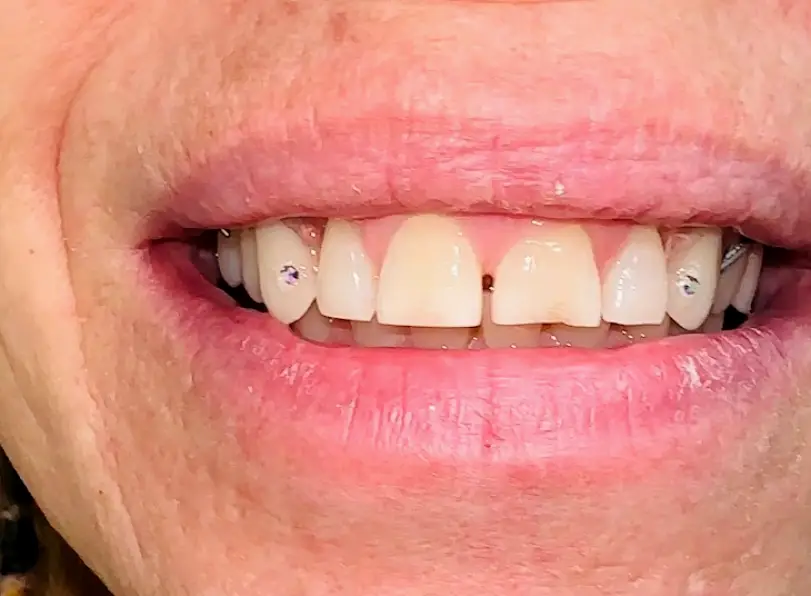 Pottstown Care32 Dental Helpline