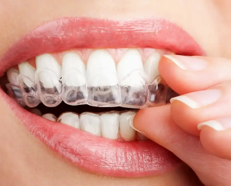 St. Louis Frost & Otto Orthodontics