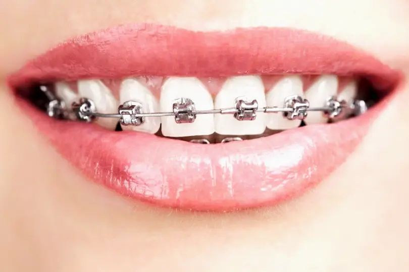 Summer Smile Dental South Gate