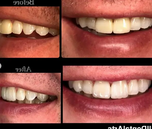 All Dental Arts Warren