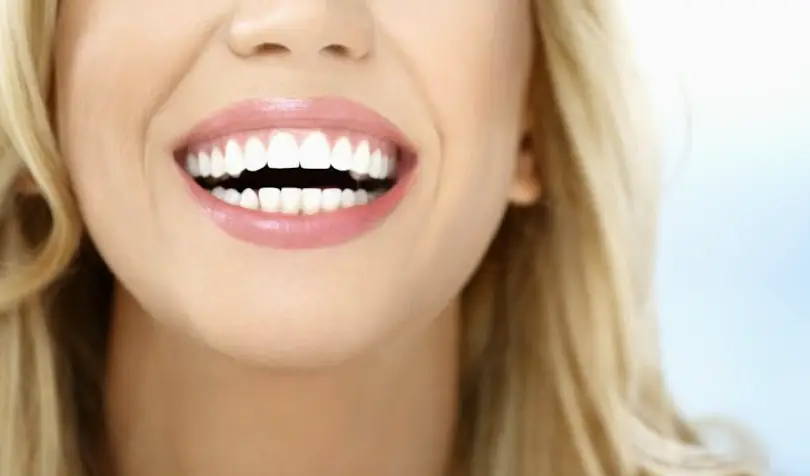 Abbotsford Happy Orthodontics - Invisalign & Braces