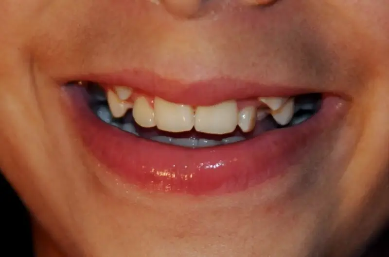Torrance Dentista Franciss Zamora DDS
