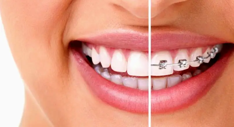 Agoura Hills Agoura Dental & Braces