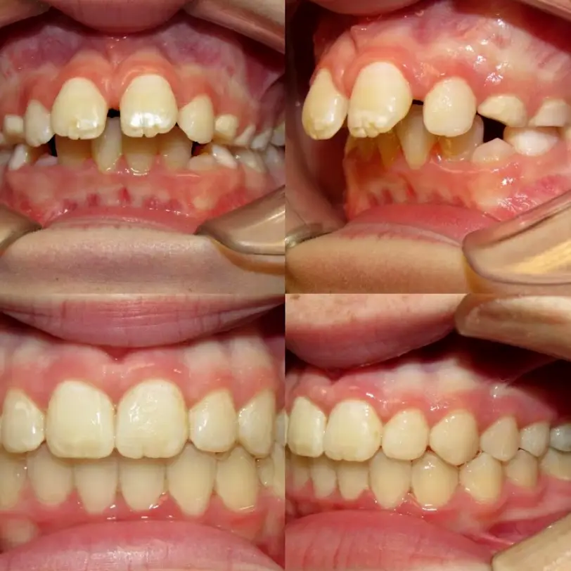 Meridian Fowler Orthodontics