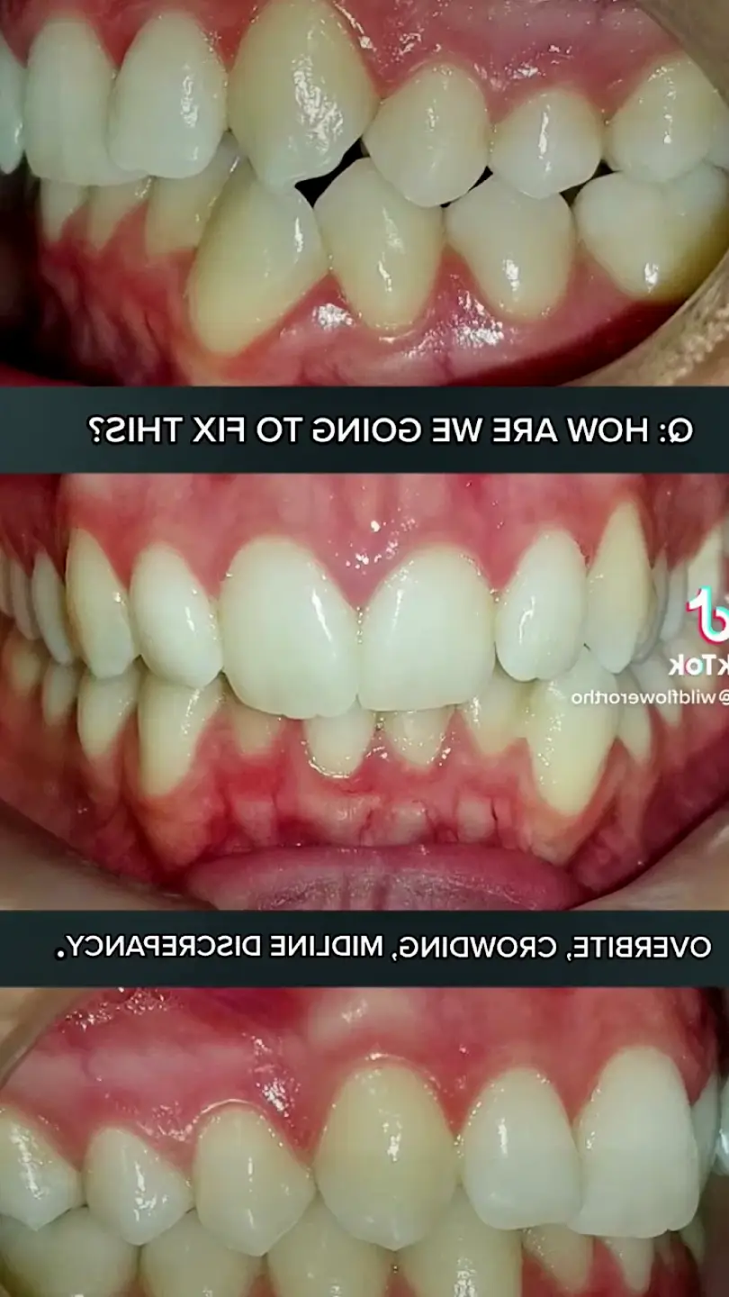 Pflugerville Wildflower Orthodontics