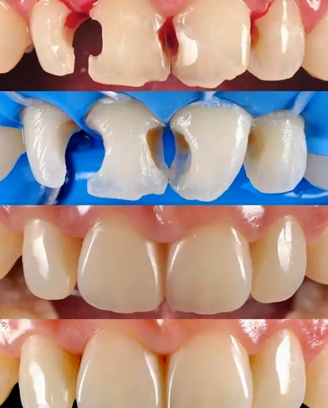 Smyrna Crystal Clear Family Dentisry