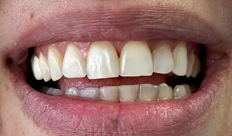 Tijuana Maxi Dental Group