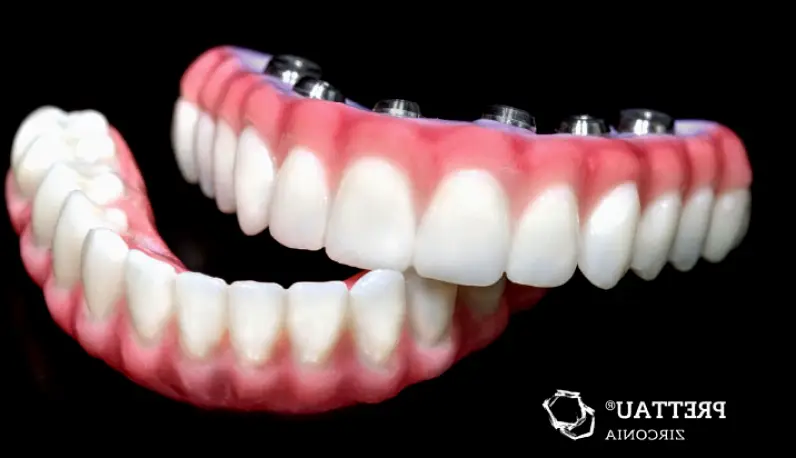 Gasport Teeth Now Buffalo