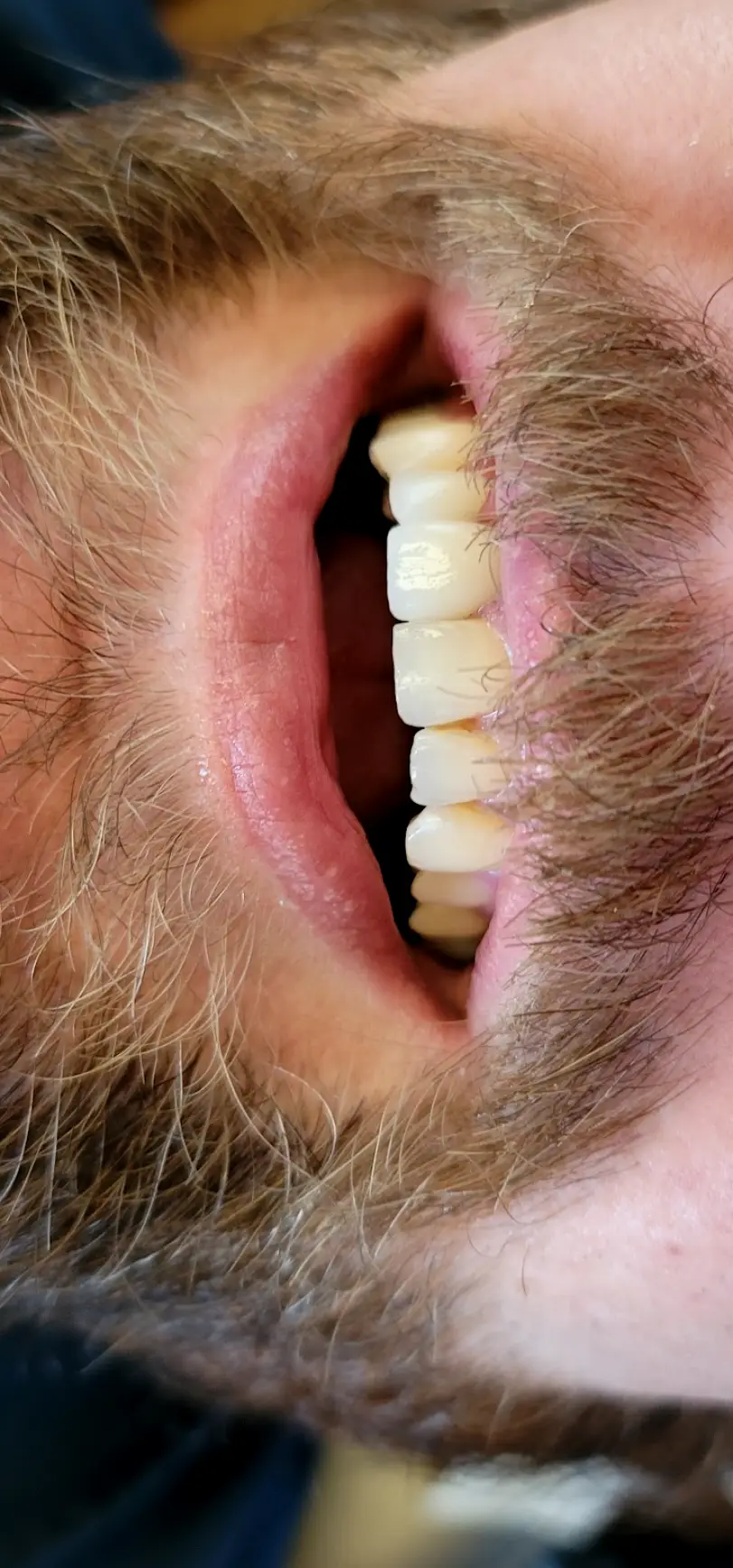 Keene Dentist - Keene Family Dental