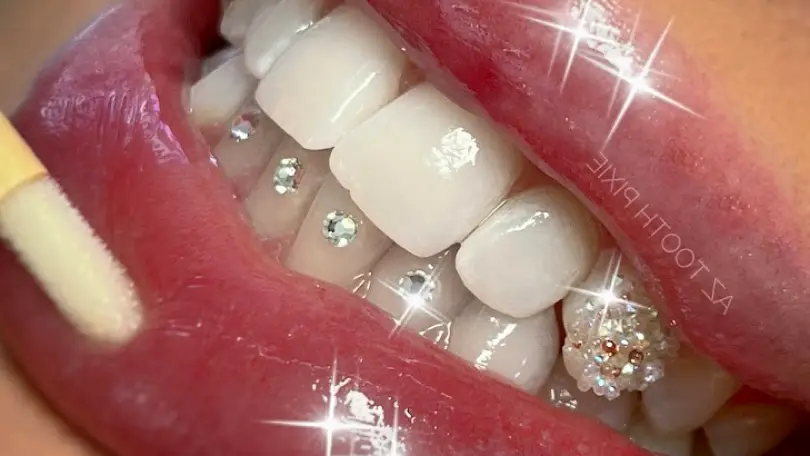 Tempe AZ Tooth Pixie