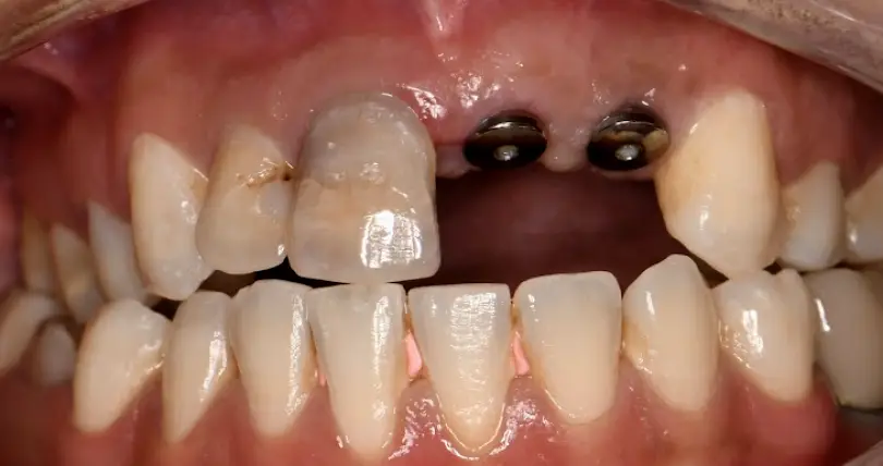 Radiant Dental Studio Bayside
