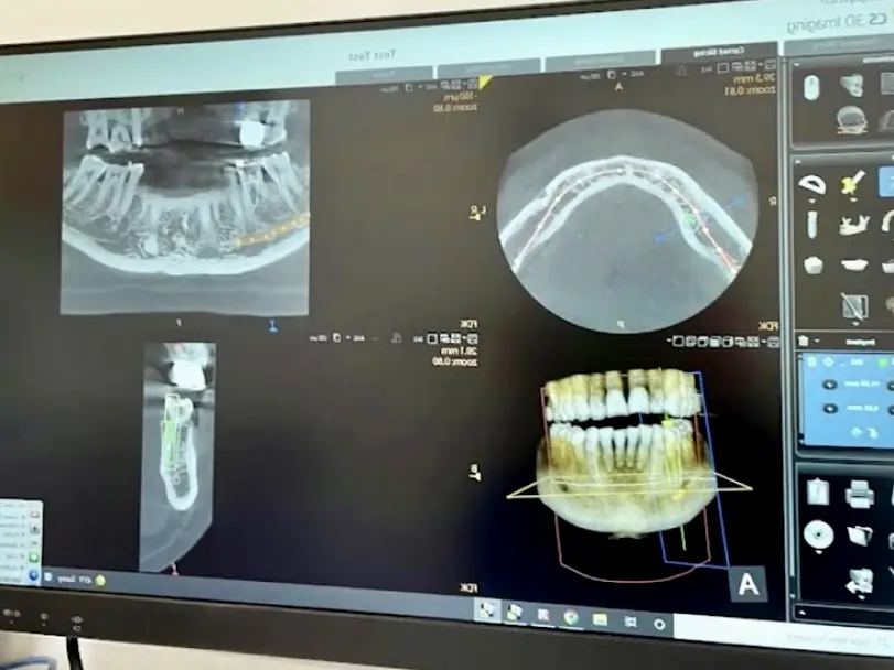 Today's Dental of Lunenburg