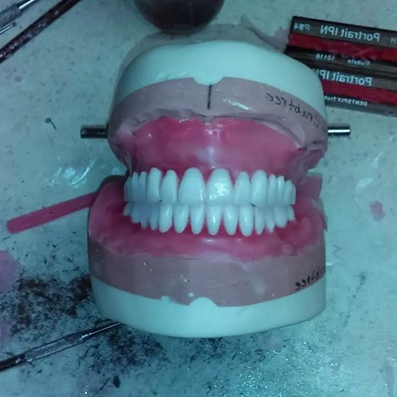 Fyffe Ace Aesthetics Dental Prosthetics