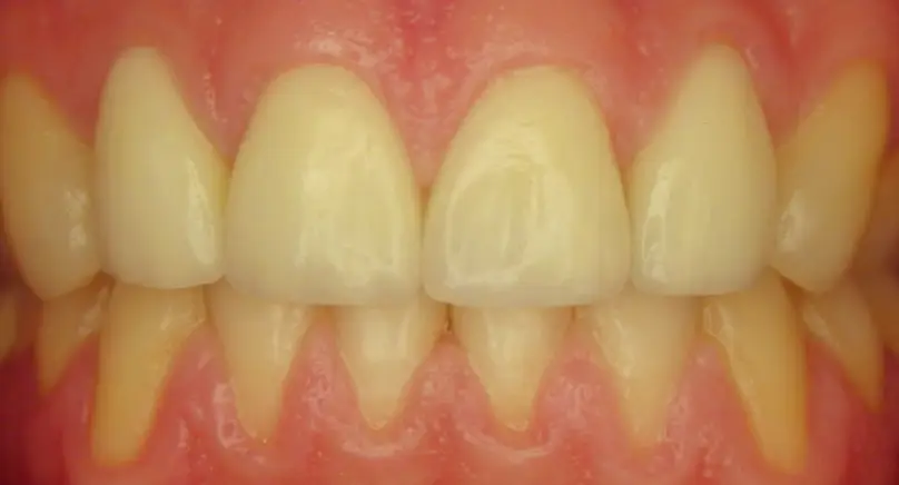 Aventura Rosenstein and Gartner Dentistry, PLLC