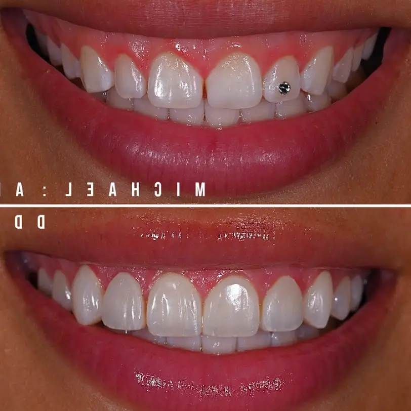 Redmond Essence of Dentistry